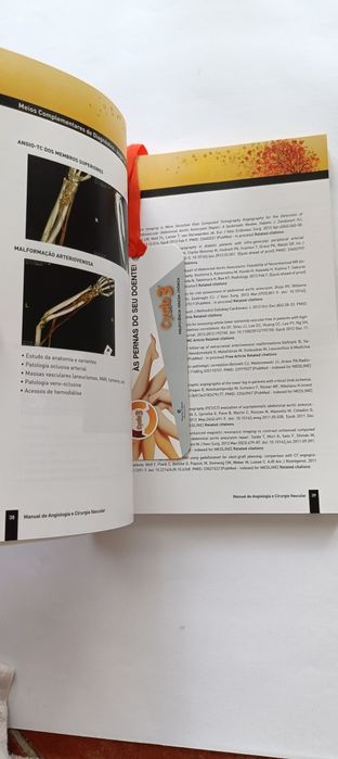 Livro NOVO Medicina Manual Angiologia e Cirurgia Vasc PORTES INCLUÍDOS