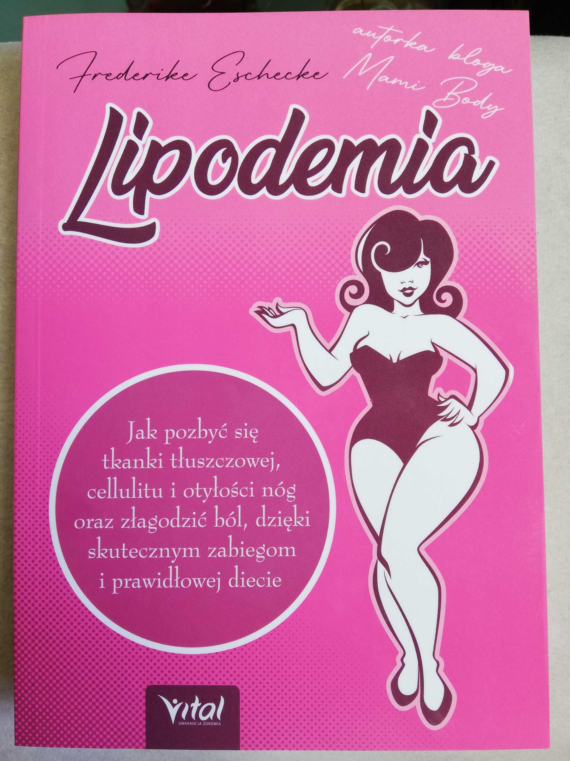Lipodemia - Fredericke Eschecke