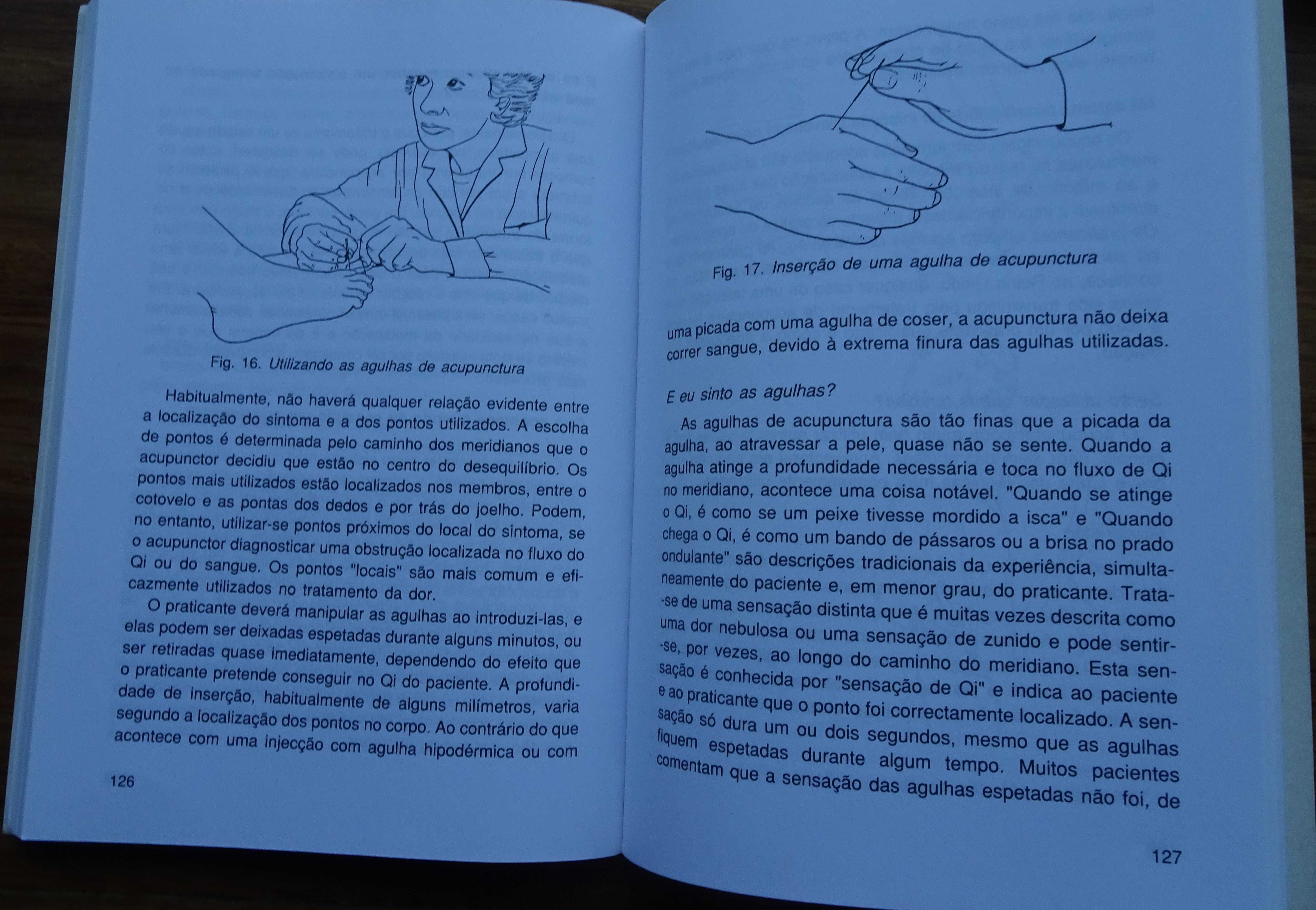 A  Acupunctura de Peter Mole