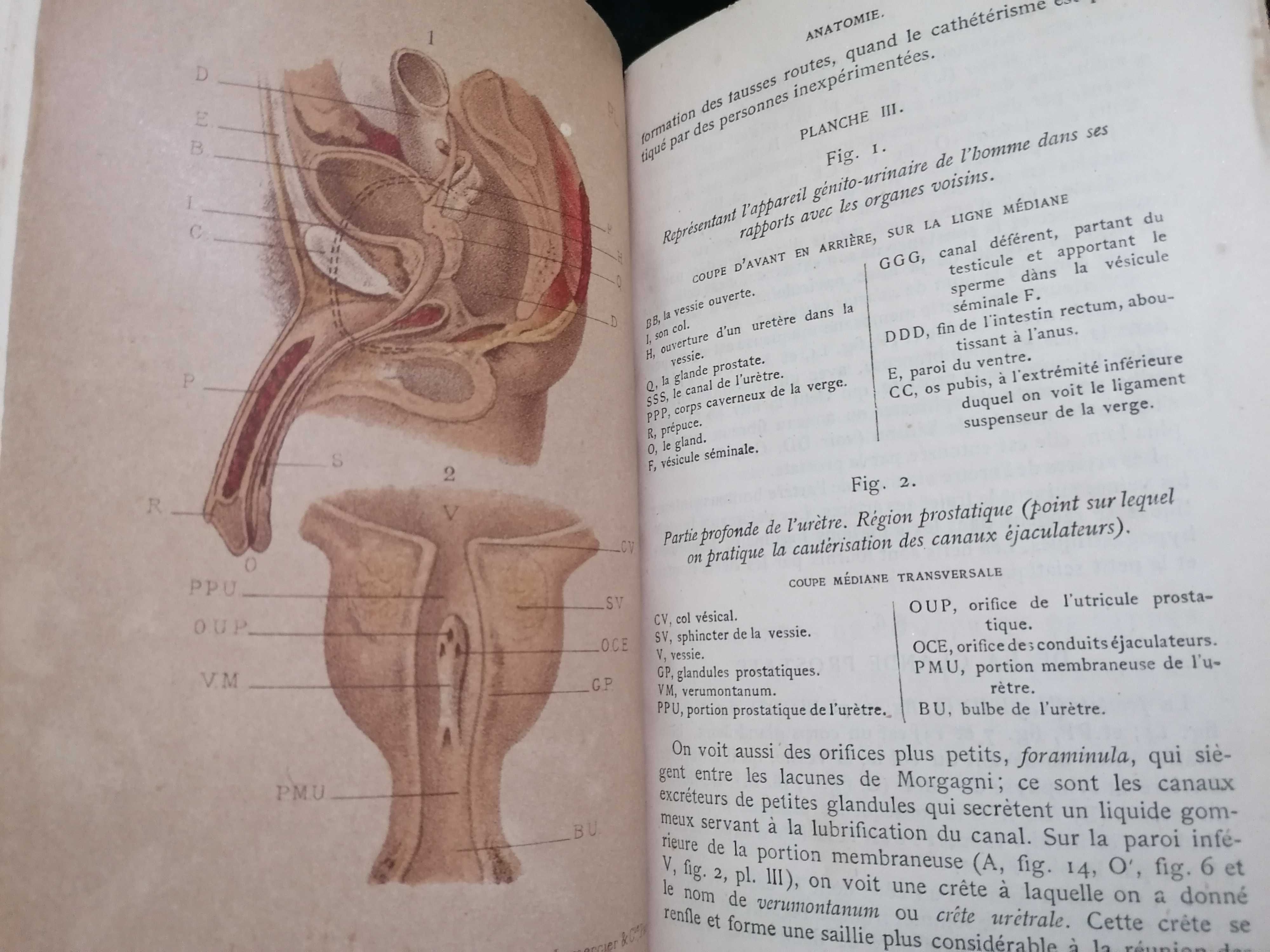 Traité Pratique des Maladies des Voies Urinaires, par Jozan Pére ,1884