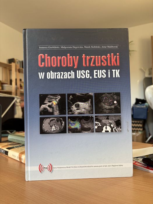 I. Gierbiński, M. Degowska, M. Stobiński - Choroby trzustki