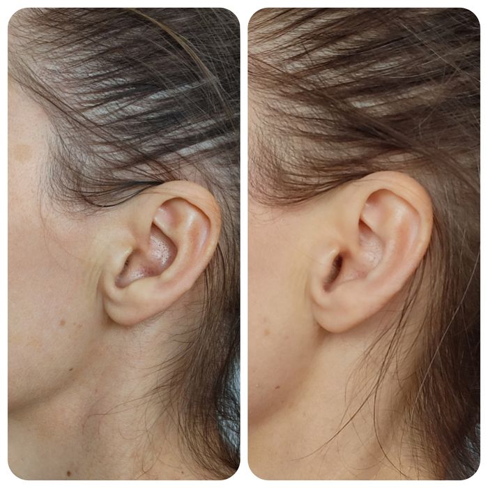 Масаж обличчя професійно