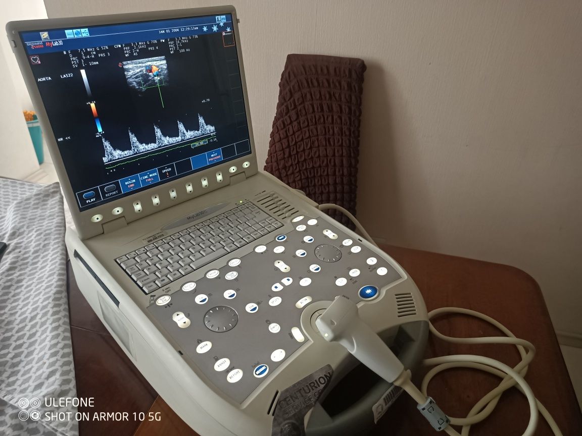 Портативний узд апарат Esaote my lab 30 cv CARDIO УЗИ 2009 р.в.