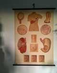 Tablice medyczne / anatomiczne / pomoce naukowe – Rak