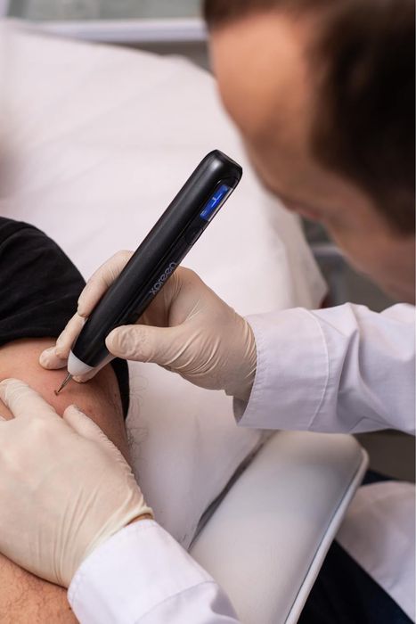 Лазерне видалення папілом