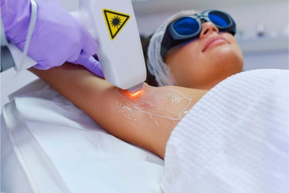 Depilação a Laser Castêlo Da Maia