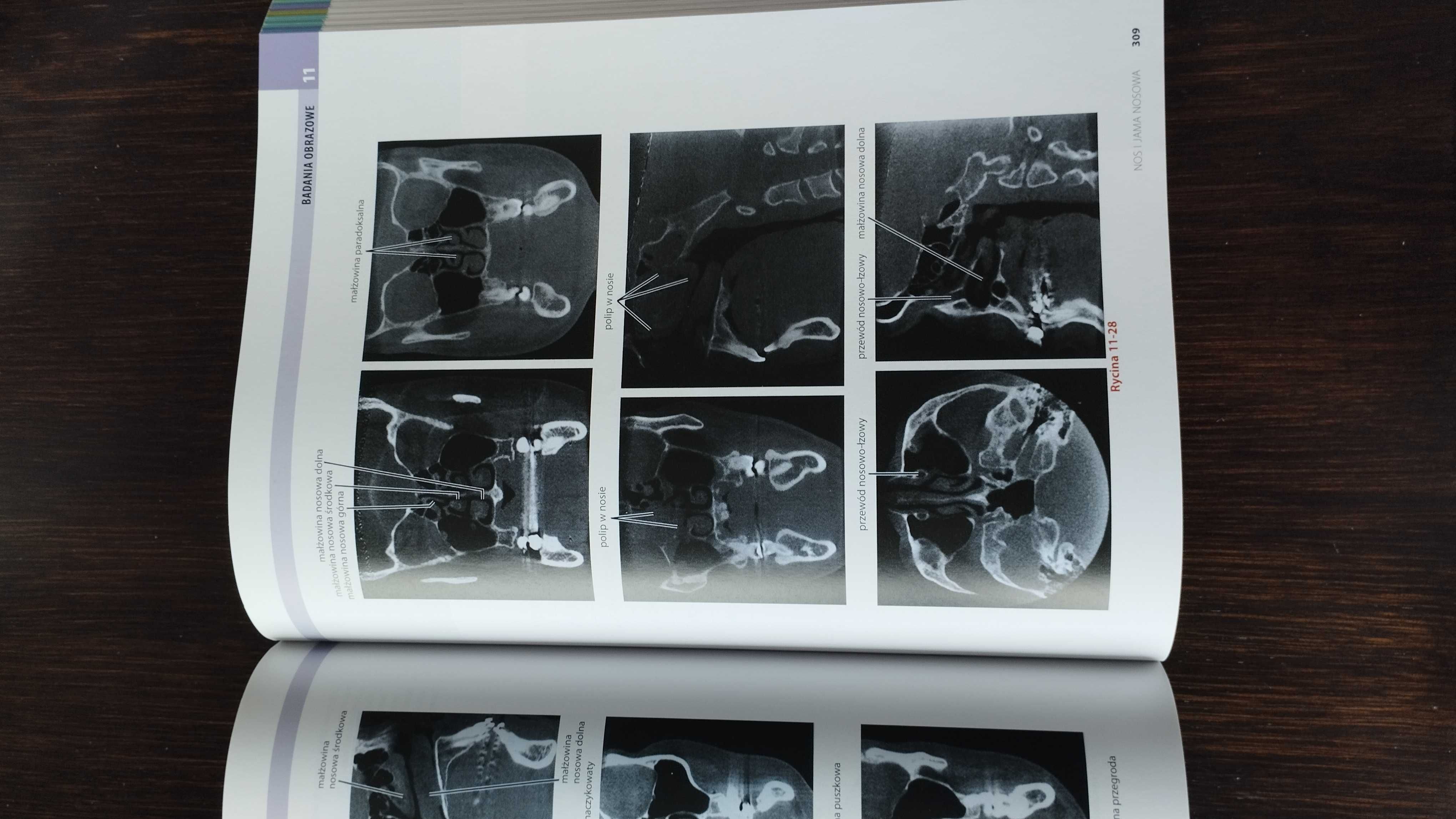 Atlas anatomiczny głowy i szyi dla stomatologów Nettera
