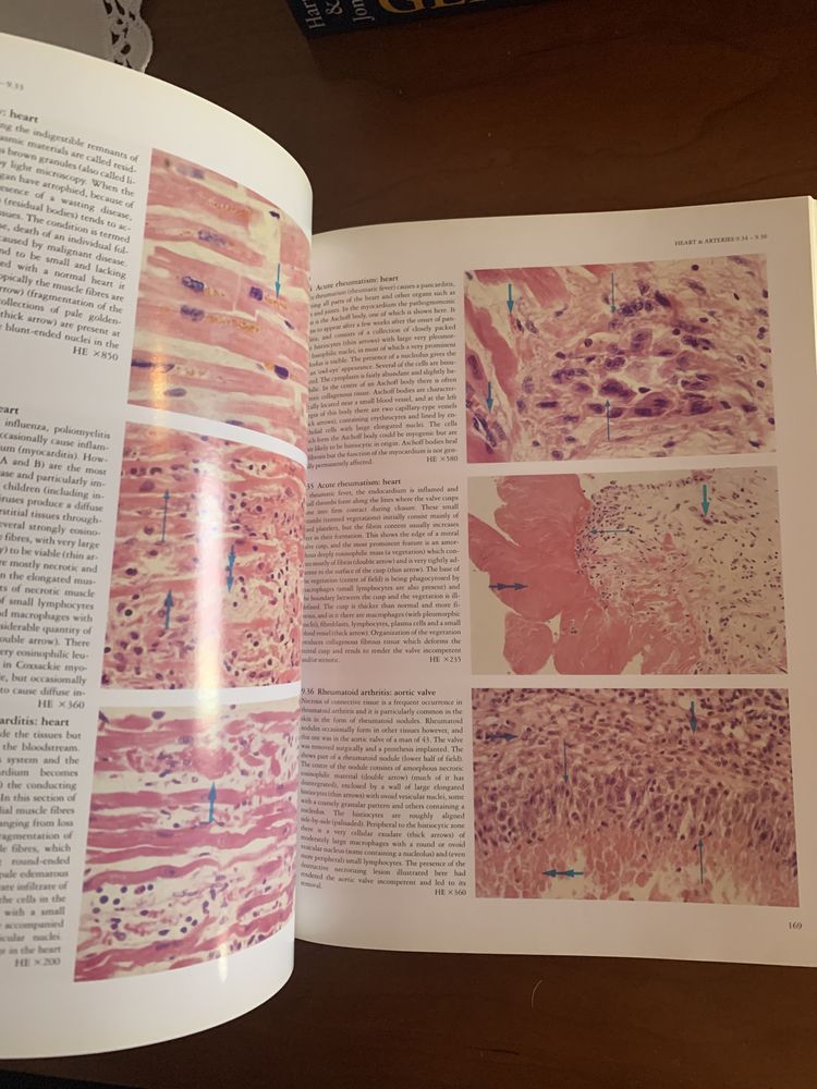 Livro Curran’s Atlas of Histopathology