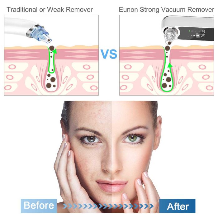 Вакуумний очищувач для обличчя Eunon DW-01 пор обличчя