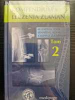 Kompendium leczenia złamań T. 2 - K. Egol, K. Koval, Zuckerman