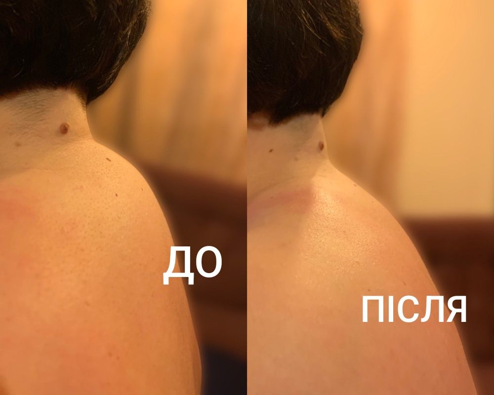 Професійний масаж! Доступні ціни! Результат!