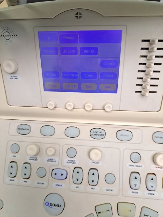 Узд Ultrasonix SonixSP