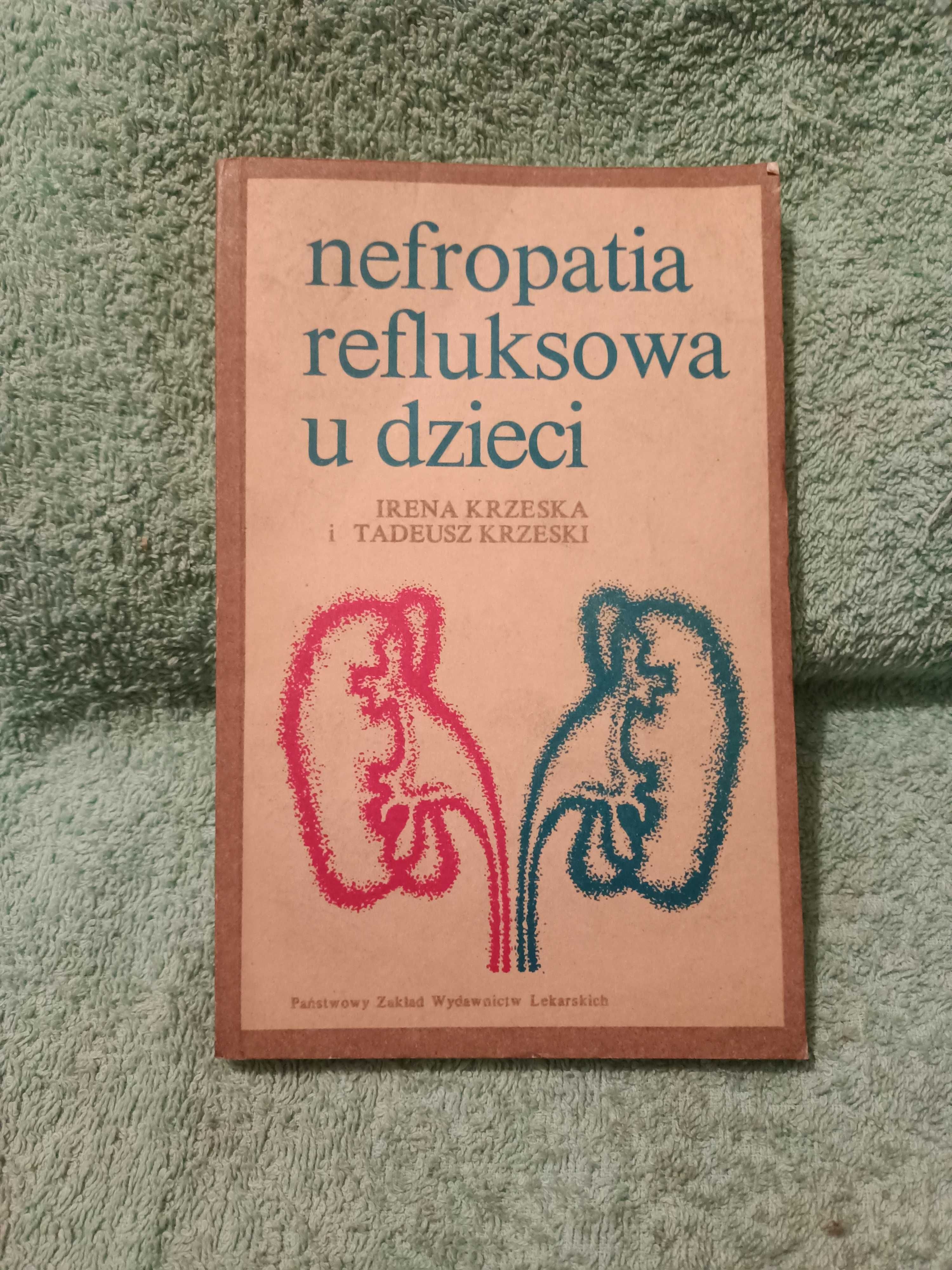 Nefropatia refluksowa u dzieci - Krzeska I.