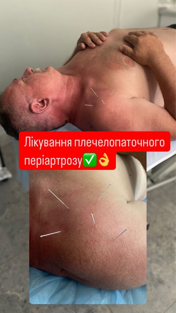 Мануальний терапевт вертебролог остеопат  масаж