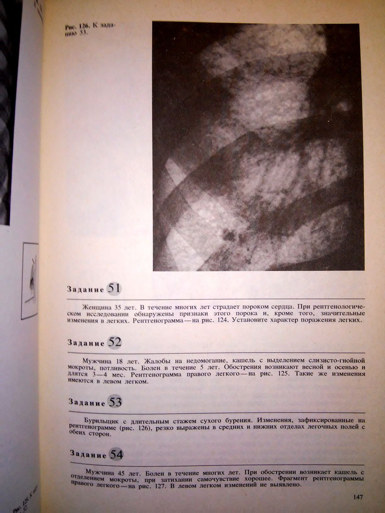 Линденбратен Медицинская рентгенология 1984