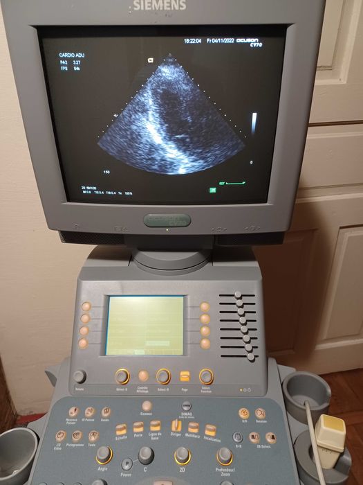 УЗД УЗИ апарат Siemens Acuson CV70 (кардіологічний), обмін