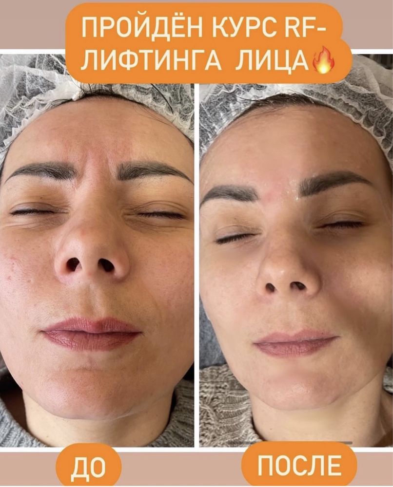 Массаж эпиляция. Улица Гурова 17 ,салон Подиум