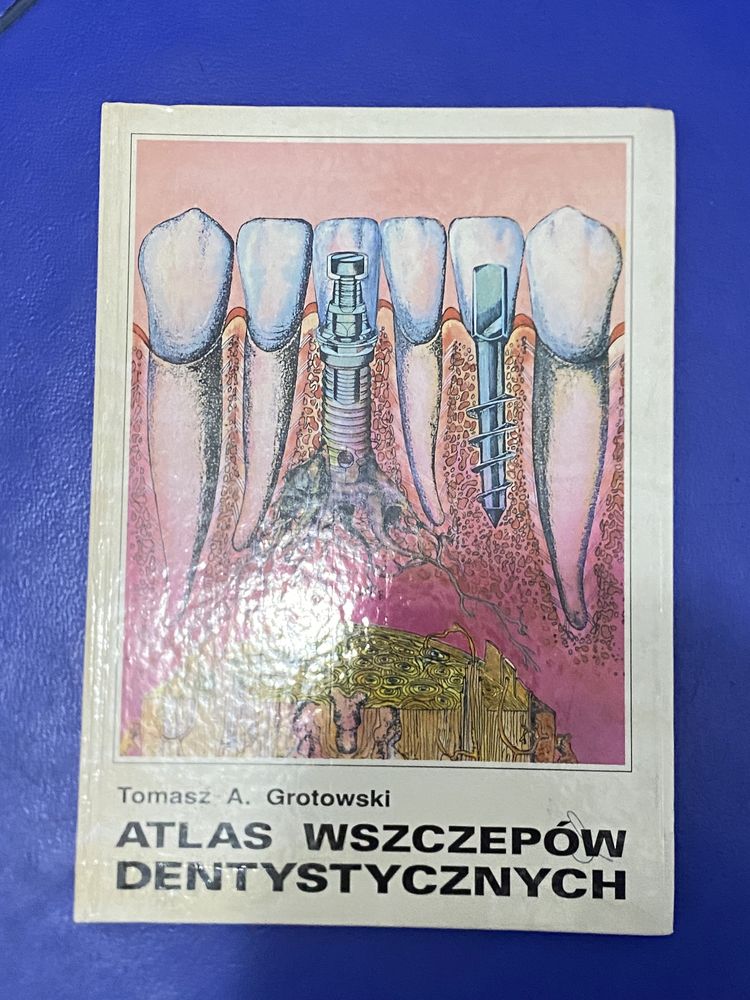 Atlas wszczepów dentystycznych Tomasz Andrzej Grotowski