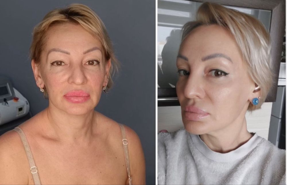 Косметолог мед образование. эпиляция. шугаринг. татуаж. ламинирование