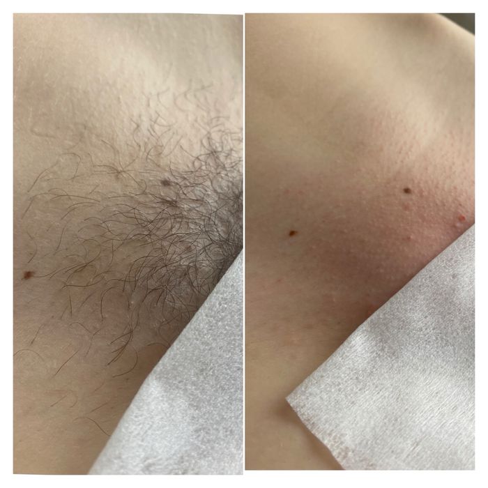 Депіляція воскова, шугарінг Київ, метро Чернігівська