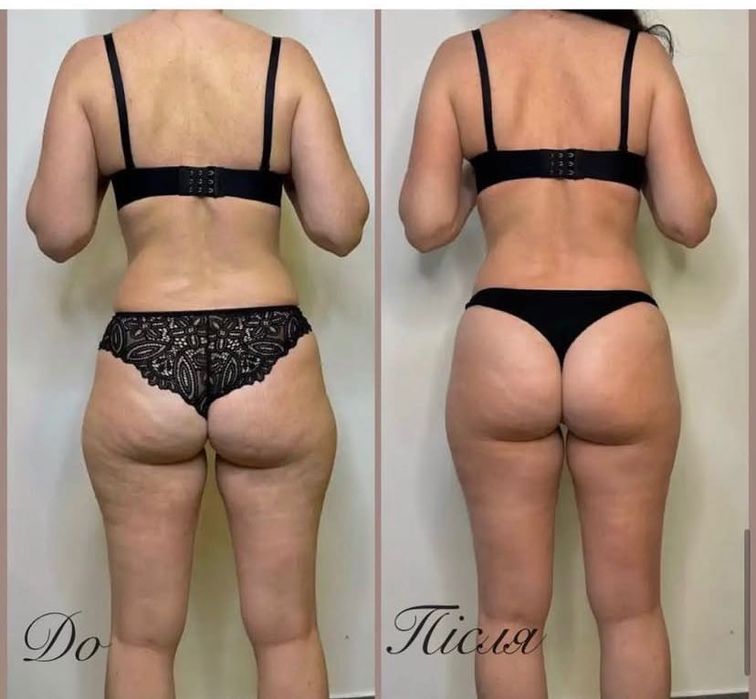 Масаж, косметологія