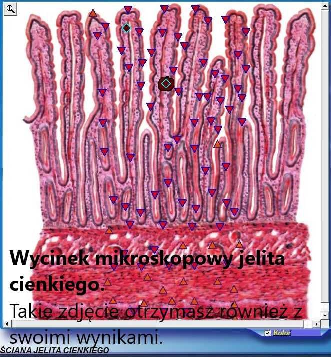 Badanie Biorezonansem-Diagnostyka Skanerem 3D - NEOMED Śląsk