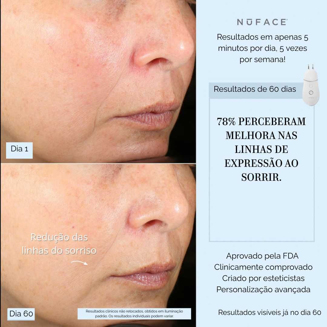 NuFACE Trinity+ com aplicador para lábios e sobrancelhas