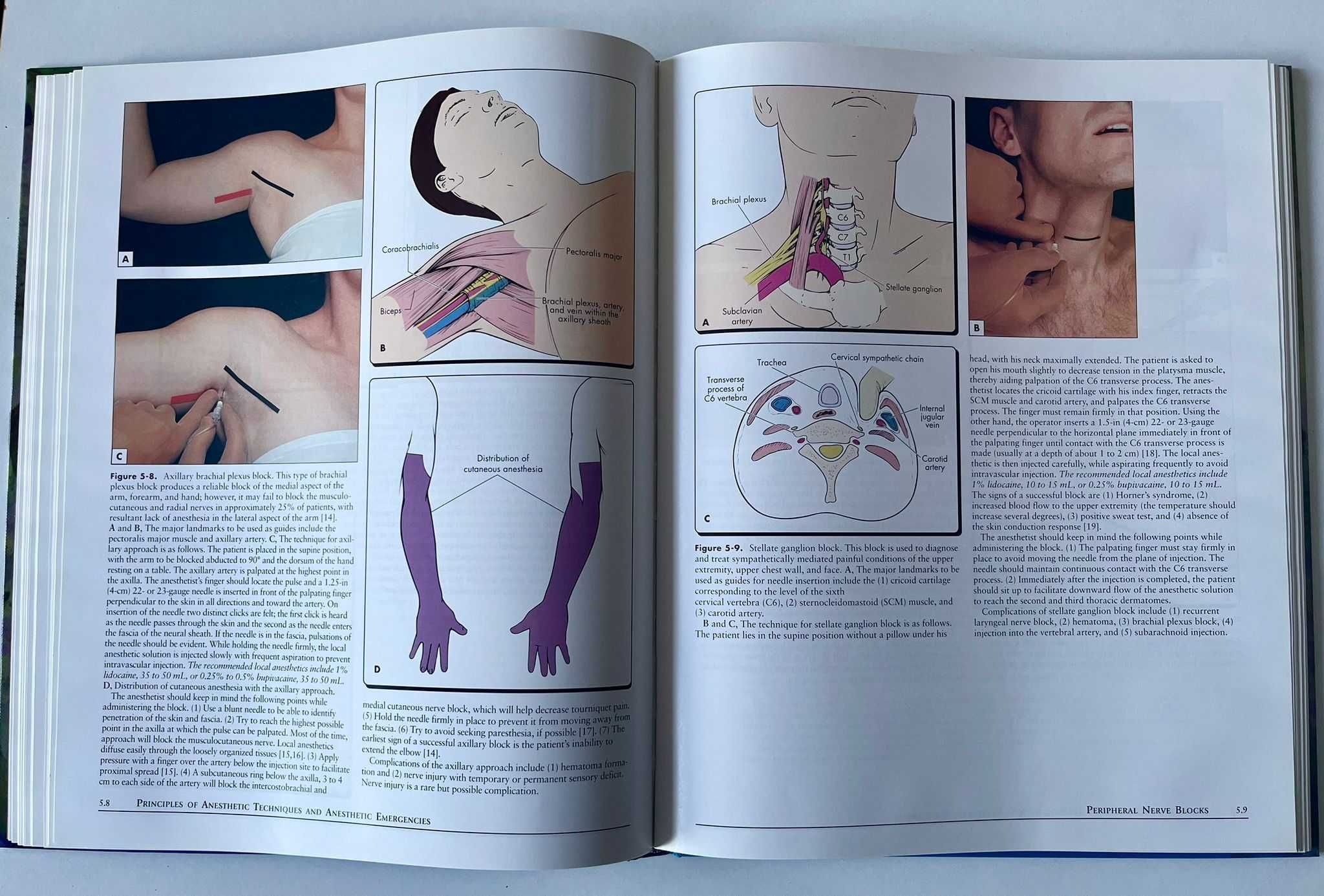 Atlas of anesthesia - Volume IV