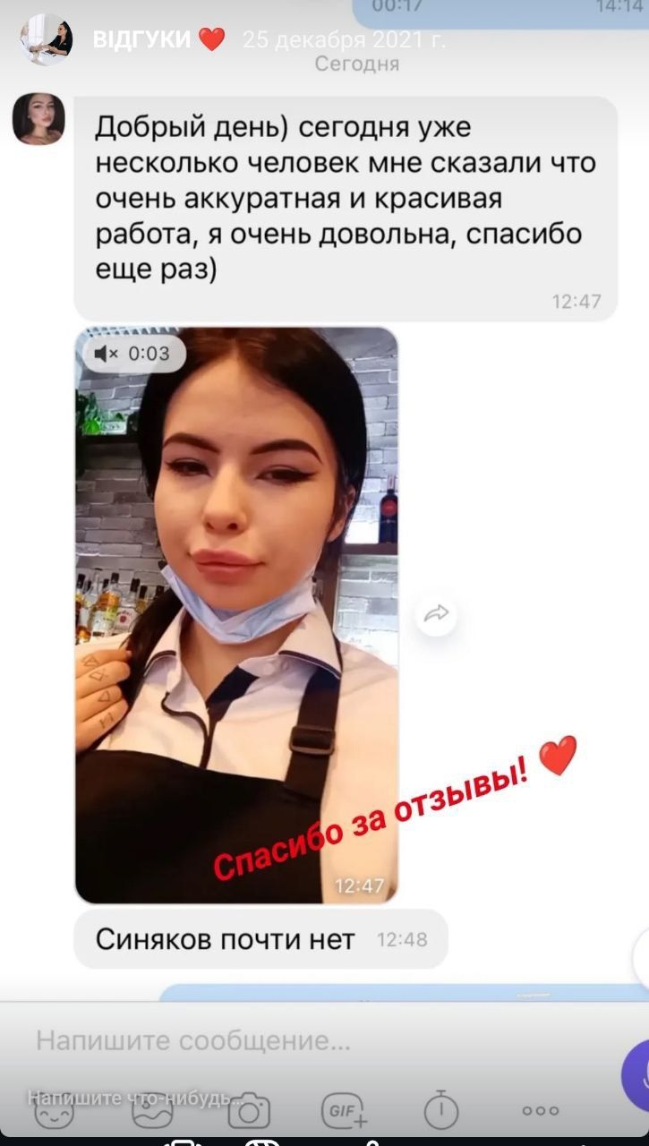 Збільшення губ, ботокс, біоревіталізація