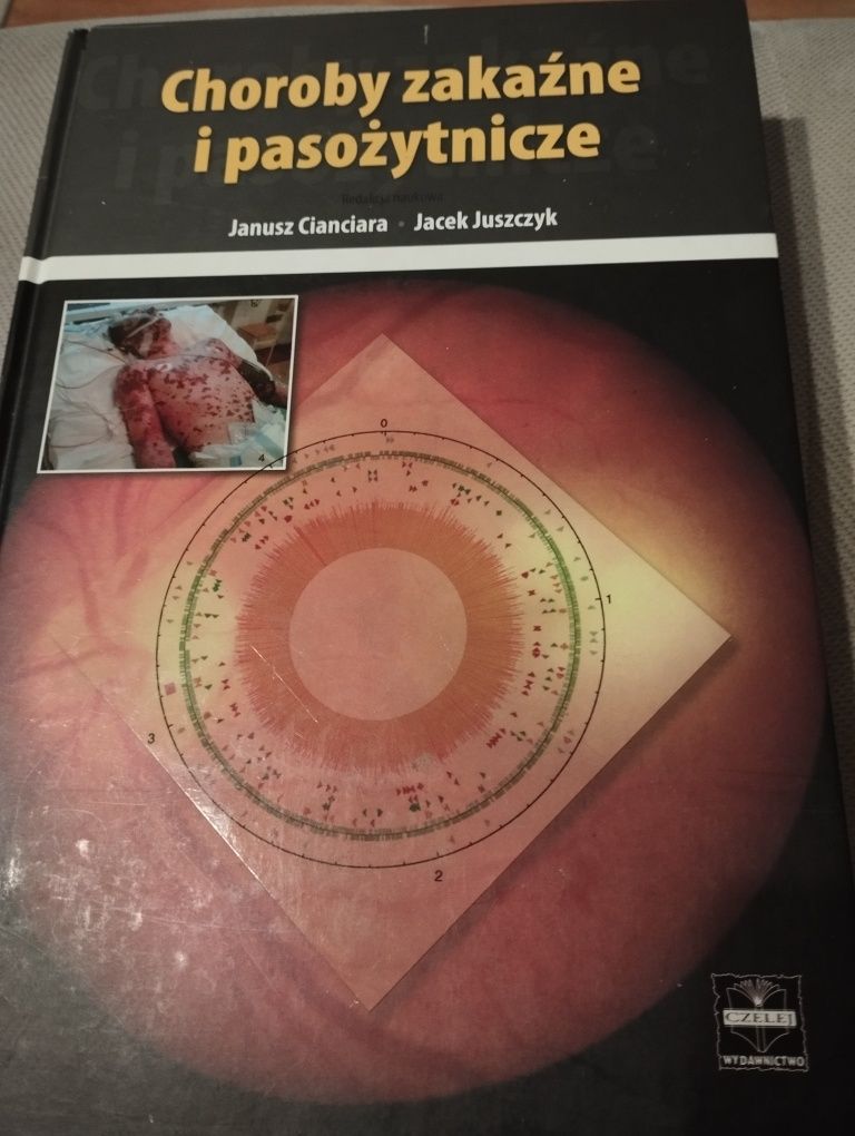 Choroby zakaźne i pasożytnicze Cianciara
