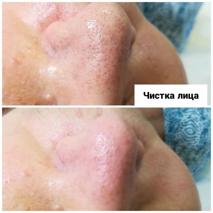 Массаж лица - 600 грн, Косметолог, Оболонь