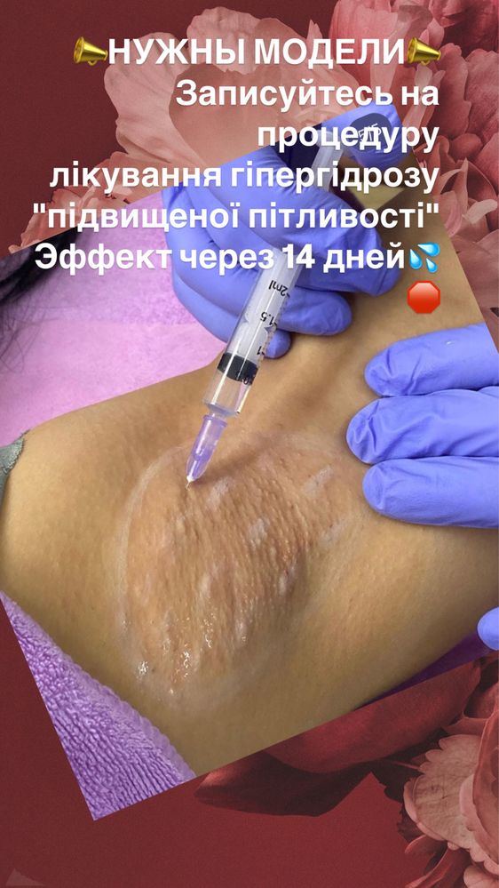 УВИЛЕЧЕНИЯ ГУБ  Перманент губы брови