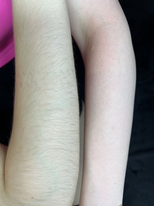 Воскова депіляція Оболонь