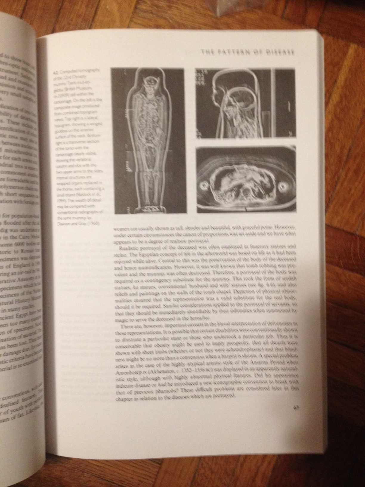 Ancient Egyptian Medicine (Medycyna starożytnego Egiptu) - John Nunn