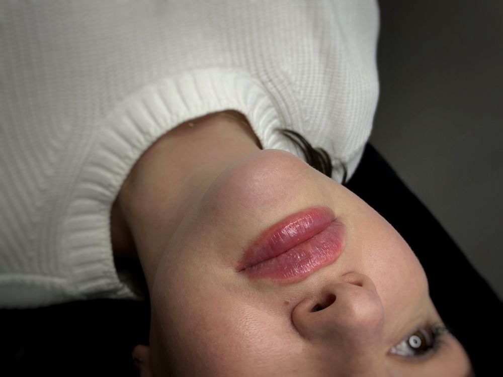 Увеличение губ от 1800! косметолог, ботокс био- мезо- Черкассы