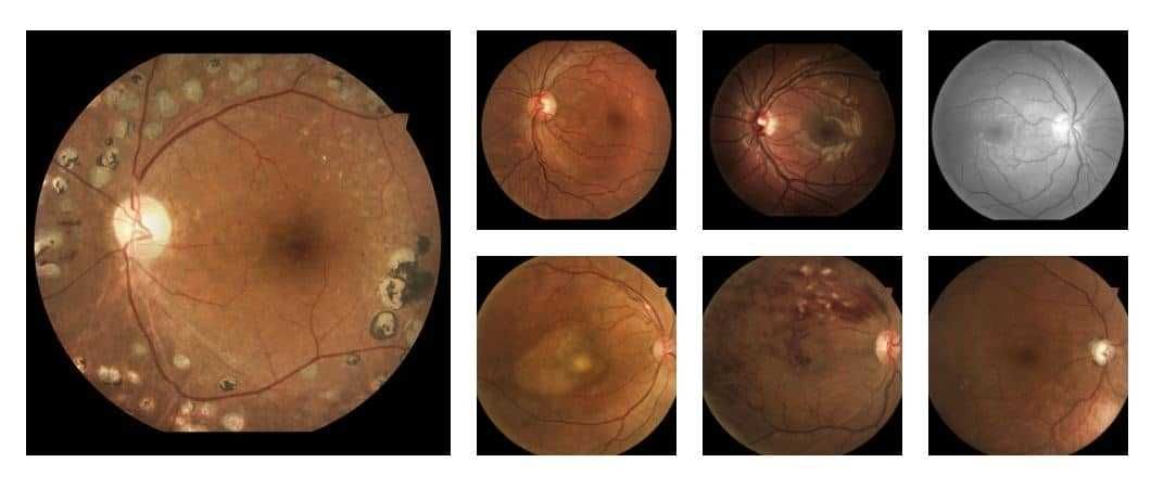 Fundus Camera CENTERVUE - DRS -- Non-Mydriatic