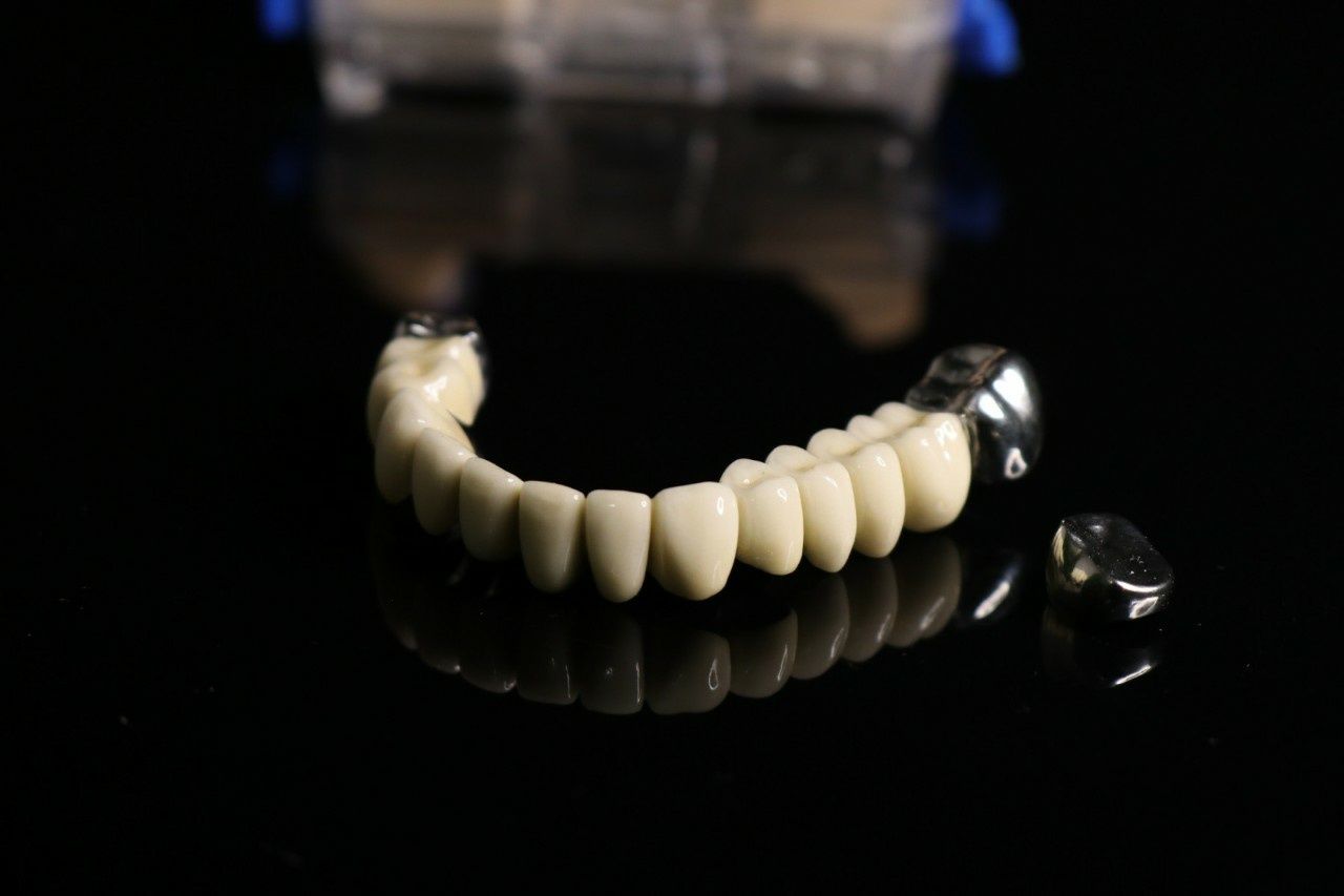 Зуботехнічні послуги протезування зуботехнічне
