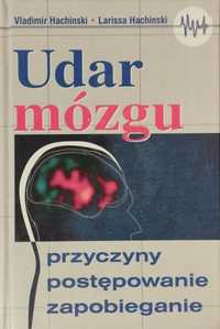 Udar mózgu. Przyczyn postępowanie zapobieganie