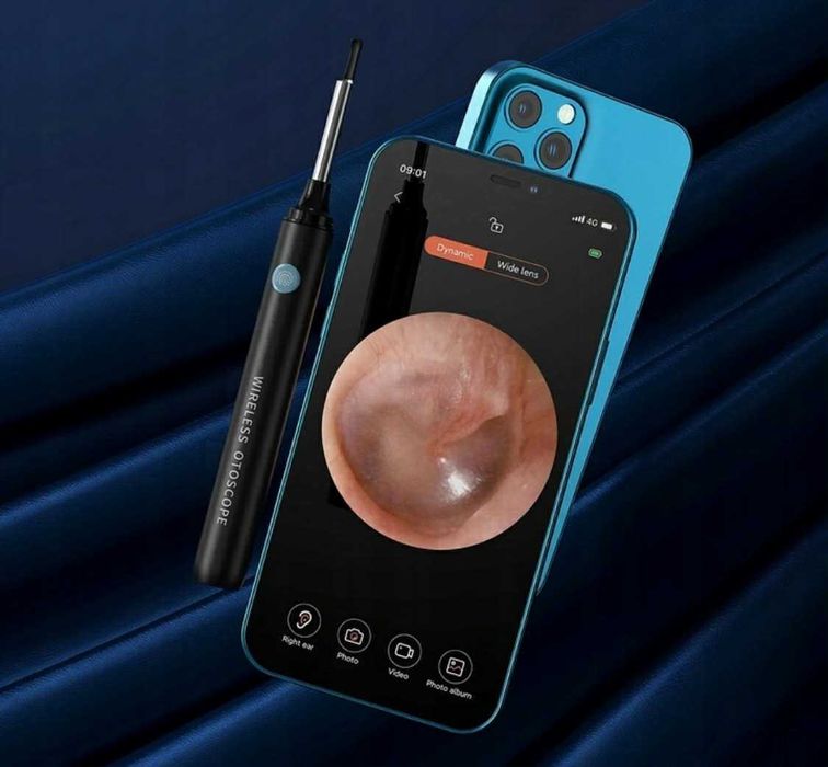 Kamerka hd do CZYSZCZENIA uszu nosa obserwacji laryngolog w domu! hit!