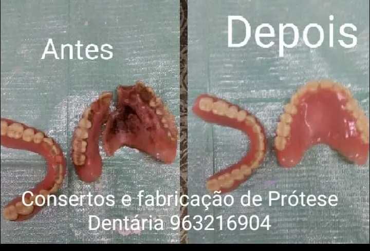 Consertos e fabricação de Prótese Dentária
