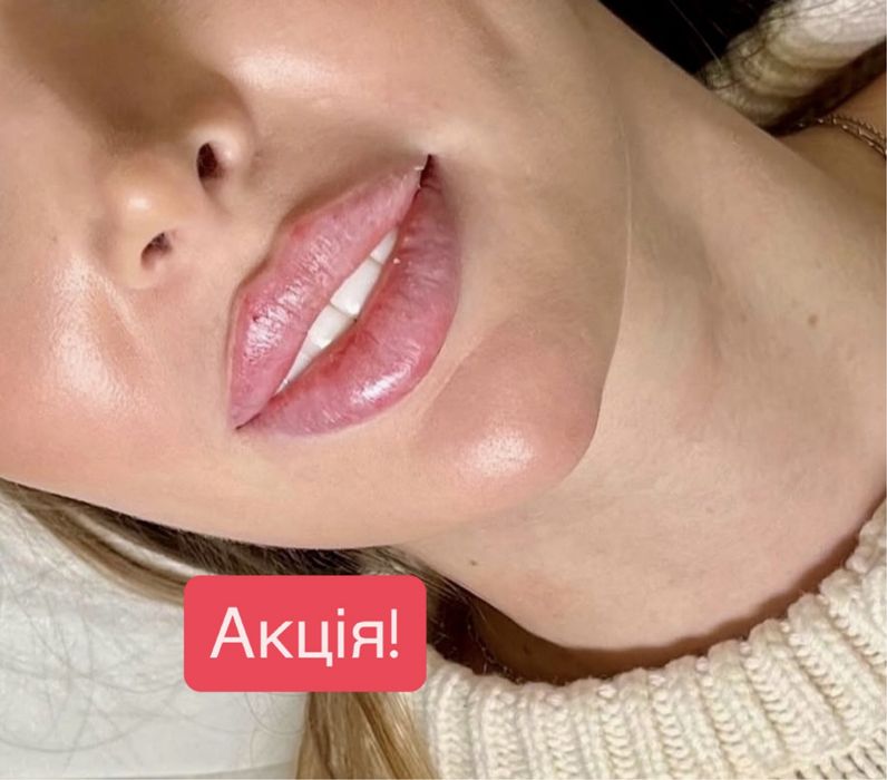 Акція на всю контурну пластику обличчя. Збільшення губ, ботокс, біо