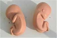 dwa modele płodu ludzkiego  , dł. ok. 5 cm, 10-12 tyg.  ciąży