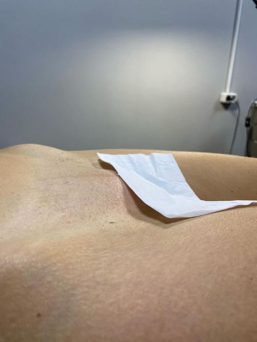 Шугаринг,воскова депіляція.