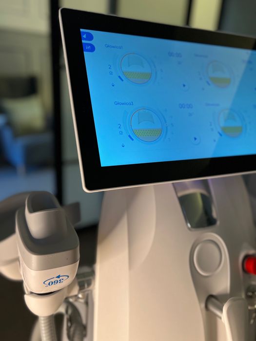 Kriolipoliza Nowa technologia