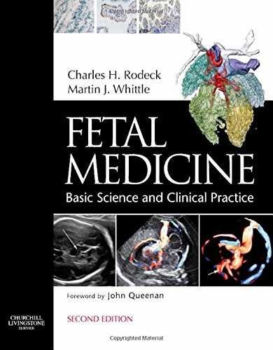 Книга Медицина плода Fetal medicine