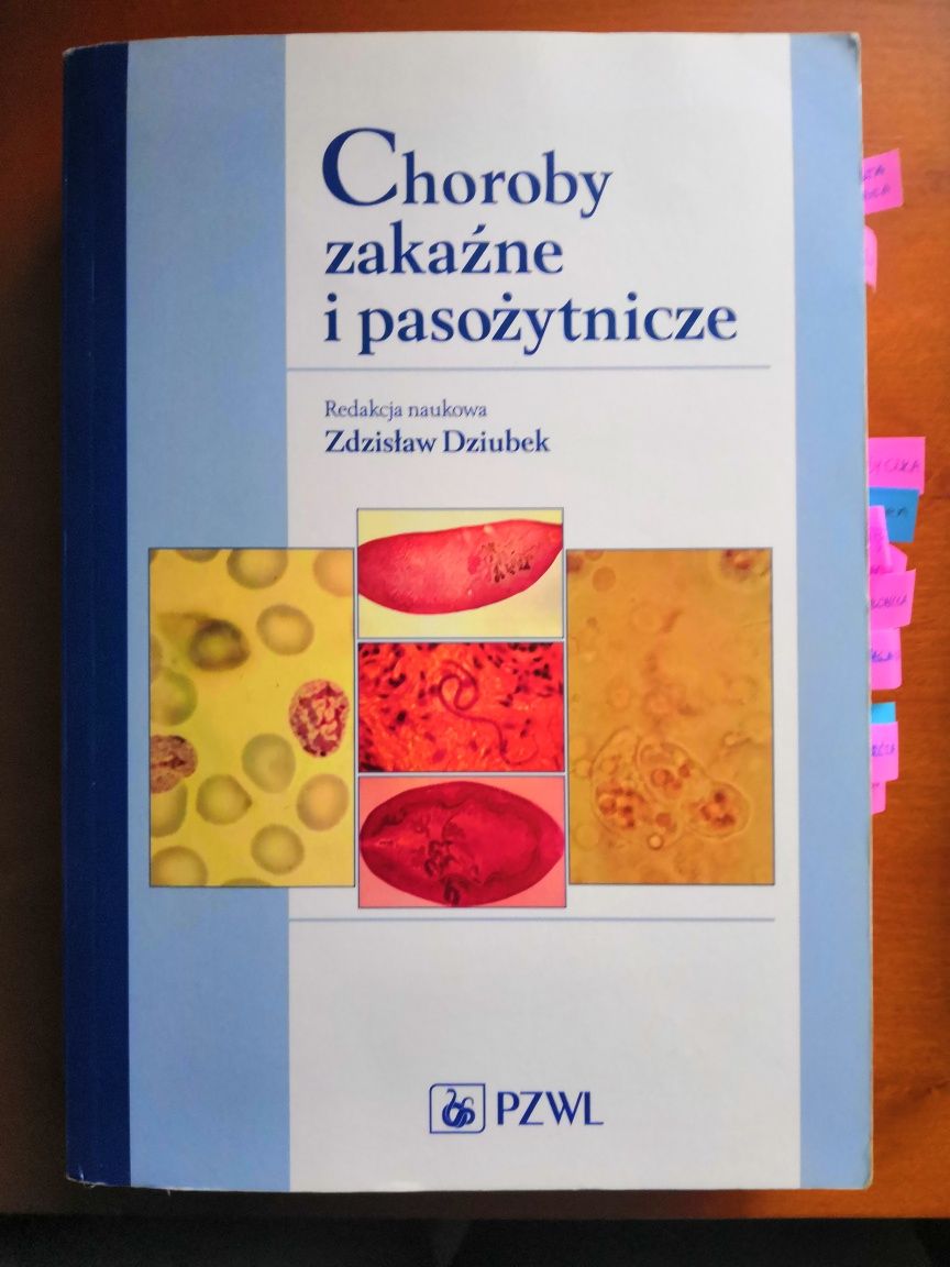 Choroby zakaźne i pasożytnicze Dziubek