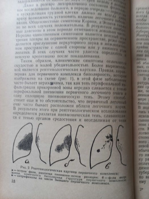 Равич-Щербо, В.А.,  Туберкулез легких у взрослых
