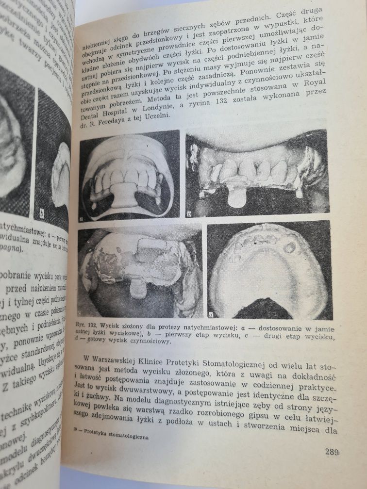 Protetyka stomatologiczna - Eugeniusz Spiechowicz