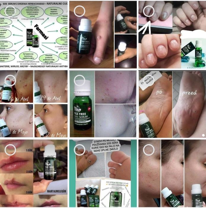 Serum  z drzewa herbacianego