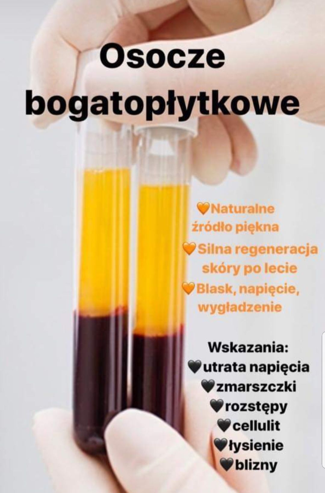 Osocze Bogatoplytkowe Autoligiczna Fibryna HITOWE Zabiegi Odmładzajace